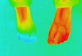 足のサーモ画像